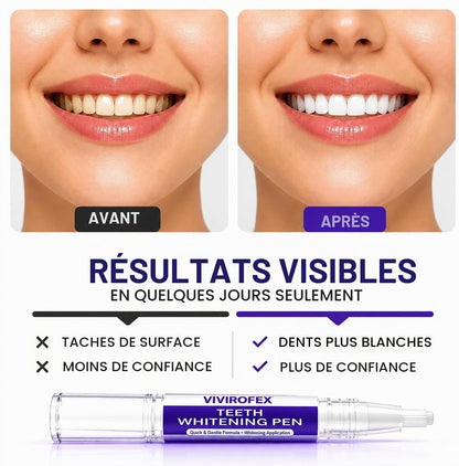 3 x Teeth Whitening Pen, Teeth Cleaning Pen, Stain Remover