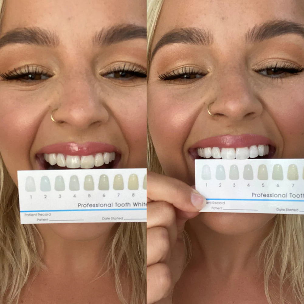 Puresmile : stylo blancheur
